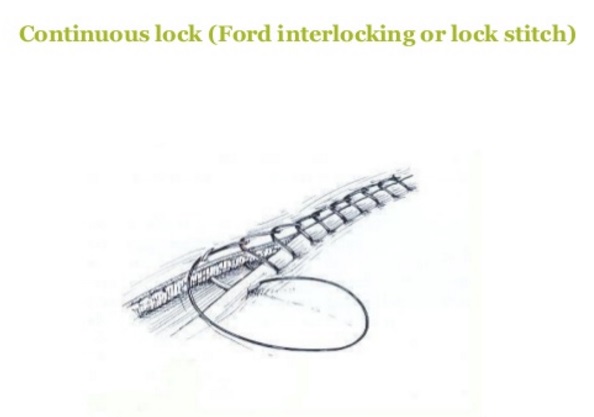 Ford Interlocking Suture Pattern