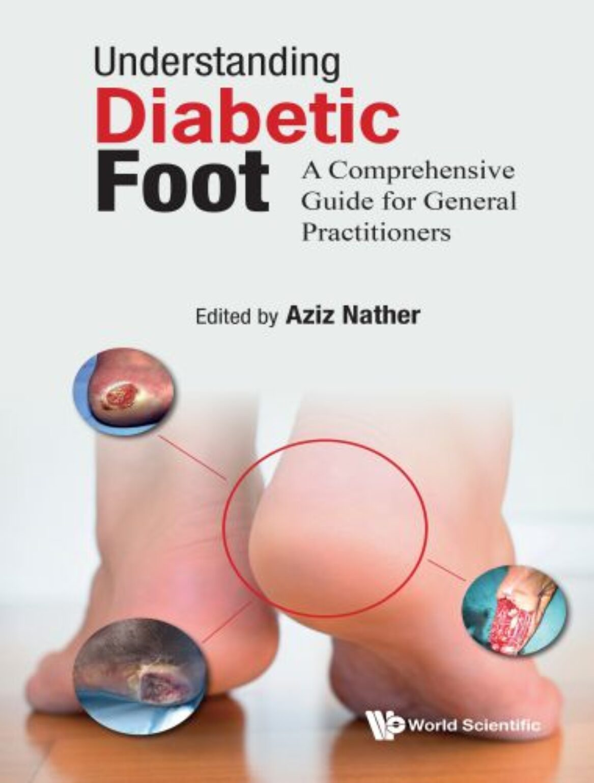 Understanding Diabetic Foot A Comprehensive Guide For General Practitioners