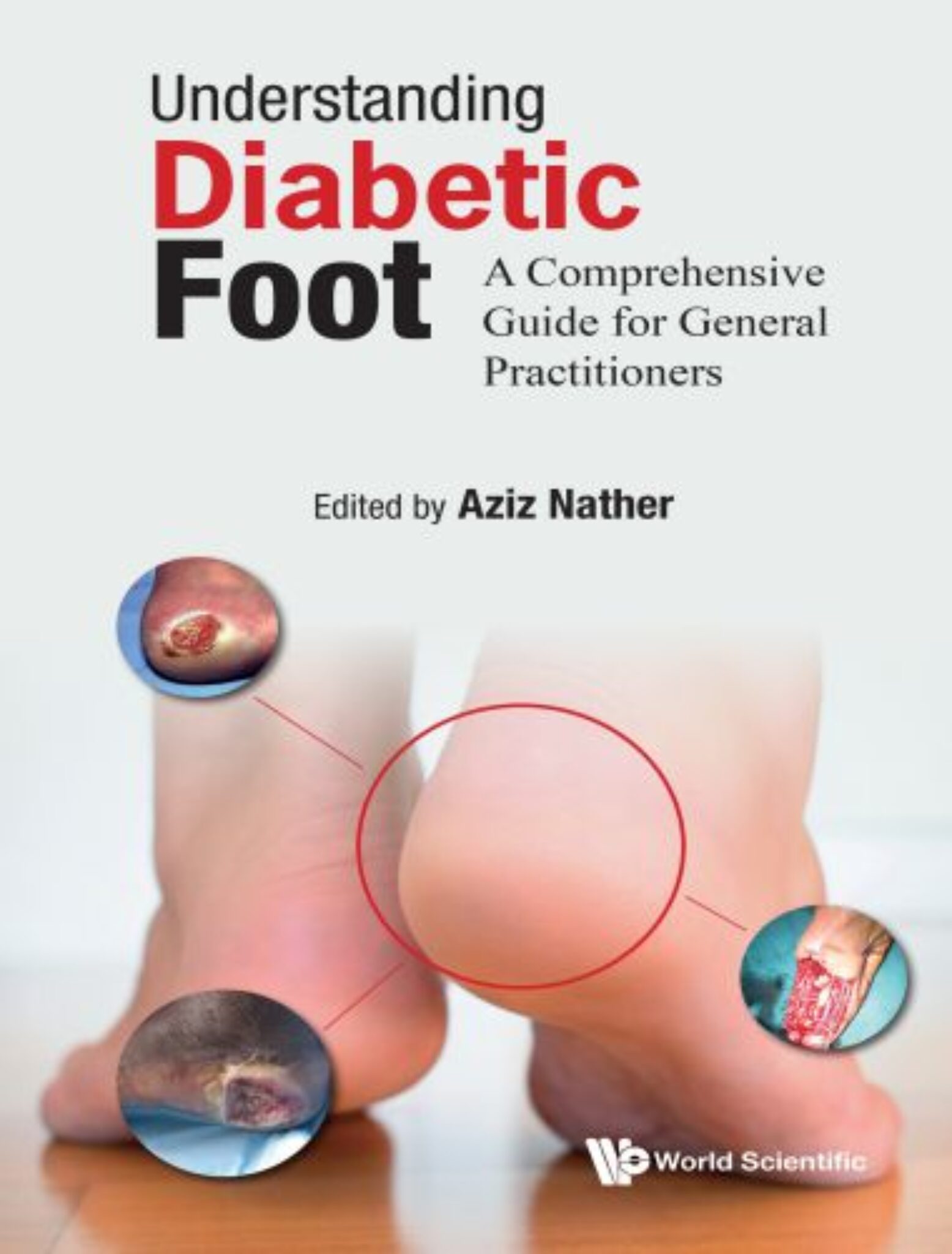 thesis on diabetic foot